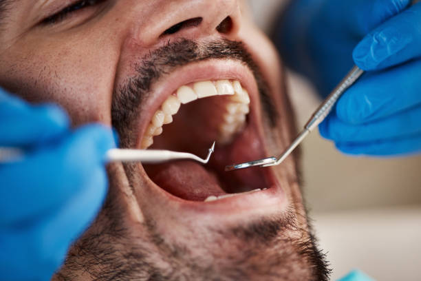 Best Broken or Chipped Tooth Repair in Orrville, OH